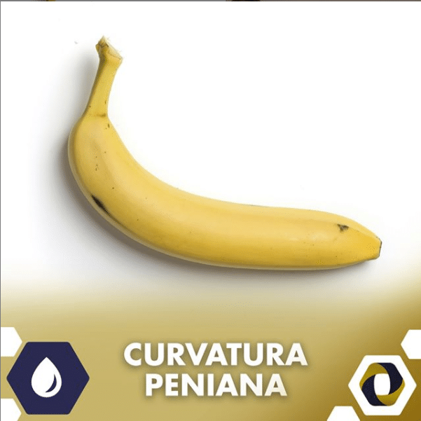 A curvatura da banana